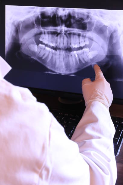 Best Emergency Dental Extractions in Round Lake Park, IL