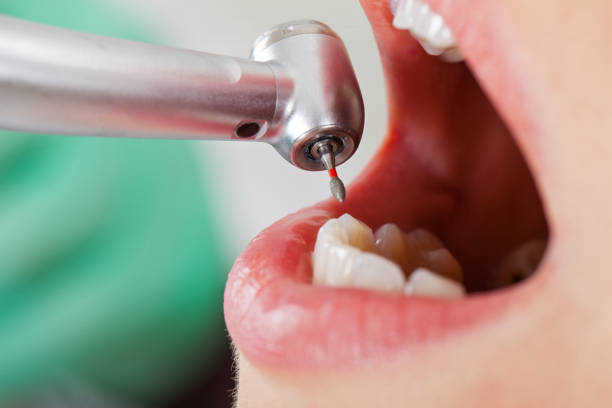 Best Mobile Emergency Dentist in Round Lake Park, IL